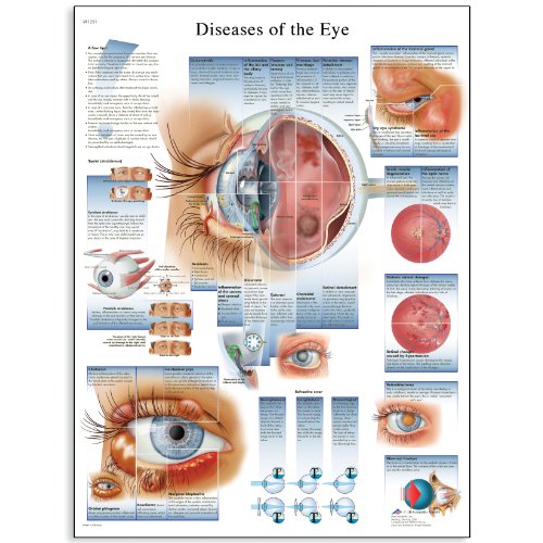 Product Cover 3B Scientific VR1231UU Glossy Paper Diseases of The Eye Anatomical Chart, Poster Size 20-Inch Widthx26-Inch Height