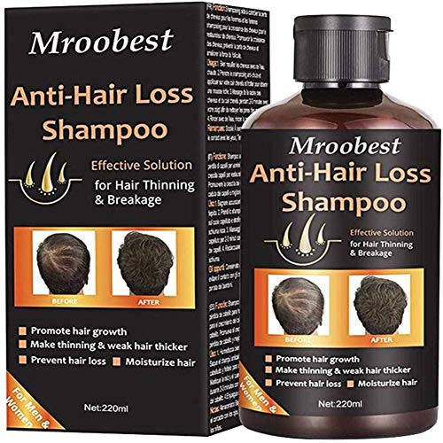 Product Cover Anti-Hair Loss Shampoo, Hair Regrowth Shampoo, Natural Old Ginger Hair Care Shampoo Effective Solution for Hair Thinning & Breakage - Organic Hair Regrowth.Products for Men & Women