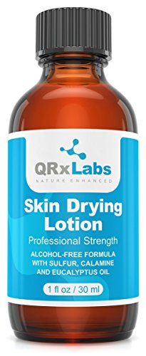Product Cover Drying Lotion - Alcohol-Free Overnight Acne & Whitehead Spot Treatment - Fights Blemishes, Pimples & Breakouts for a Clear Skin - Fast Acting Formula with Sulfur & Salicylic Acid - 1 fl oz