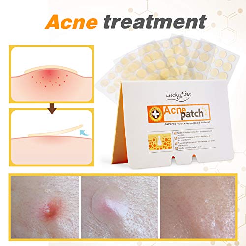 Product Cover Acne Pimple Patch, 100 Patches Y.F.M Acne Care Pimple Patch Absorbing Cover, Gentle Breathable Cover, Two Universal Sizes Hydrocolloid Bandages (20 Patches 5 Sheet)