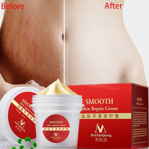 Product Cover EDTara Scar Removal Cream, Smooth Skin Repair Cream for Stretch Marks Scar Removal Skin Repair Body Cream