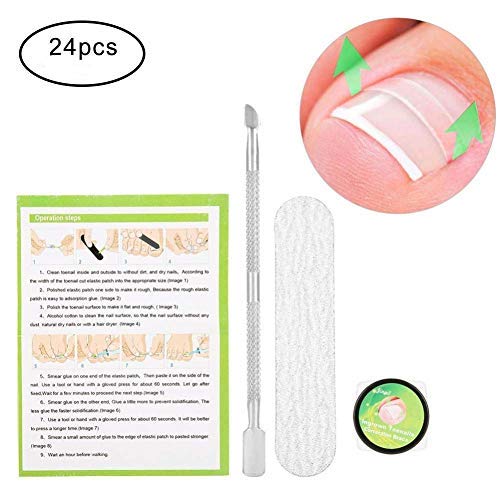 Product Cover Professional Ingrown Pincer Toenail Correction Sticker Pedicure Paronychia Recover Foot CareTool with Nail File and Cuticle Pusher(12Pcs Patches)