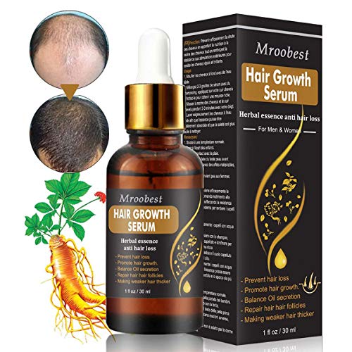 Product Cover Hair Growth Serum, Hair Treatment Serum Oil, Hair Serum, Hair Growth Treatment, Stops Hair Loss, Thinning, Balding, Promotes Thicker, Fuller and Faster Growing Hair (30ML)