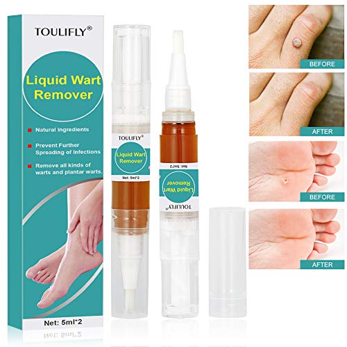 Product Cover Wart Remover,Foot Wart Remover,Plantar Wart Remover,Wart Remover Liquid Pen Corn Callus Remover Liquid for Common Warts Plantar Corn Callus Stops Wart Regrowth