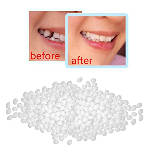 Product Cover Temporary Tooth Repair Kit Moldable Thermal Fitting Beads for Snap On Instant and Confident Smile Denture Adhesive Fake Teeth Cosmetic Braces Veneer Make You Beautiful (White, 25g)